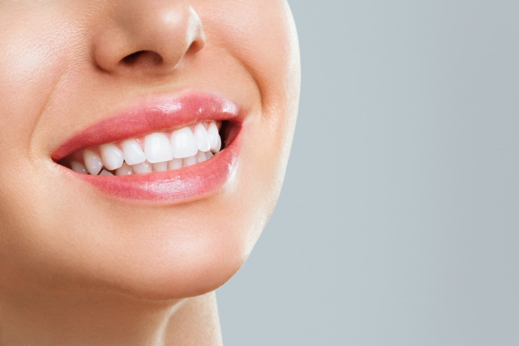 Cosmetic dentistry at iDental Dilworth in Charlotte, NC
