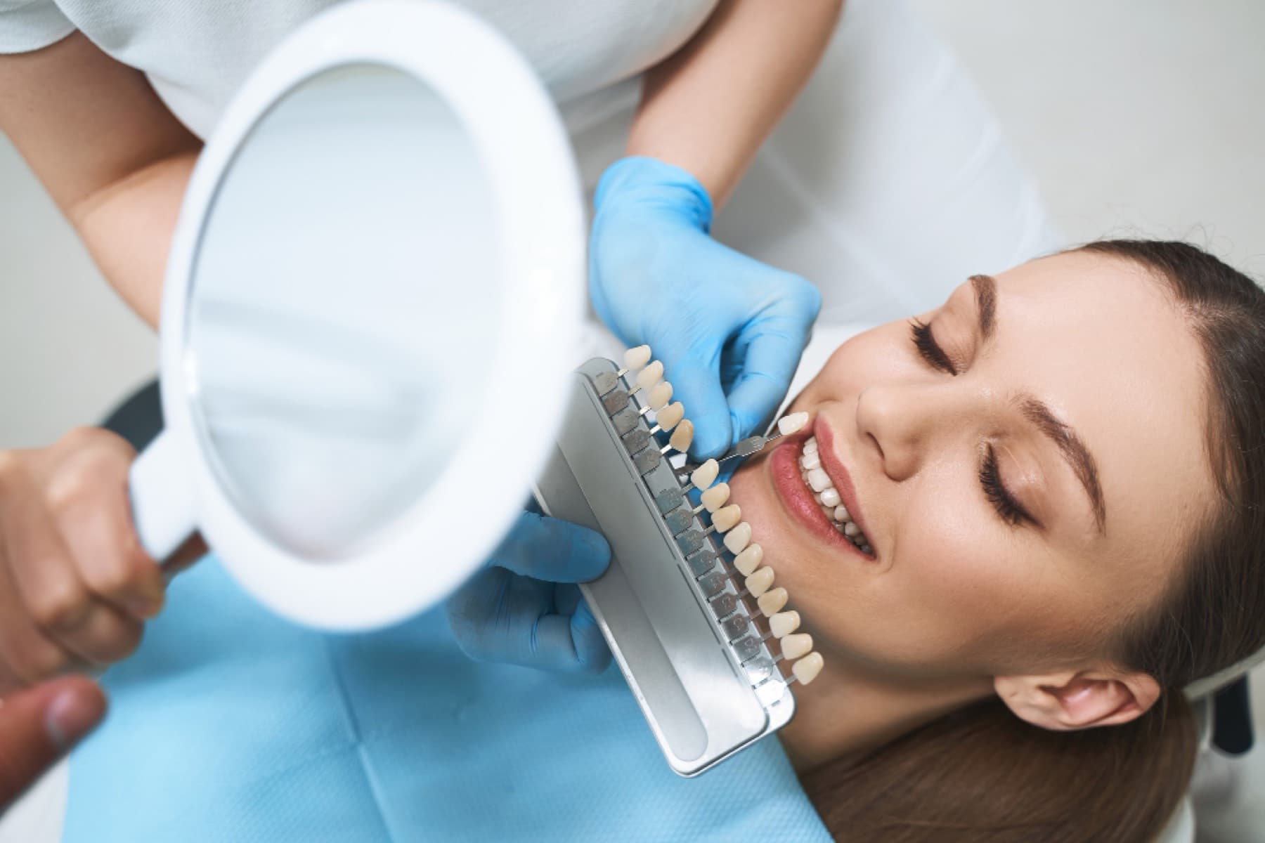 Porcelain veneers at iDental Dilworth in Charlotte, NC