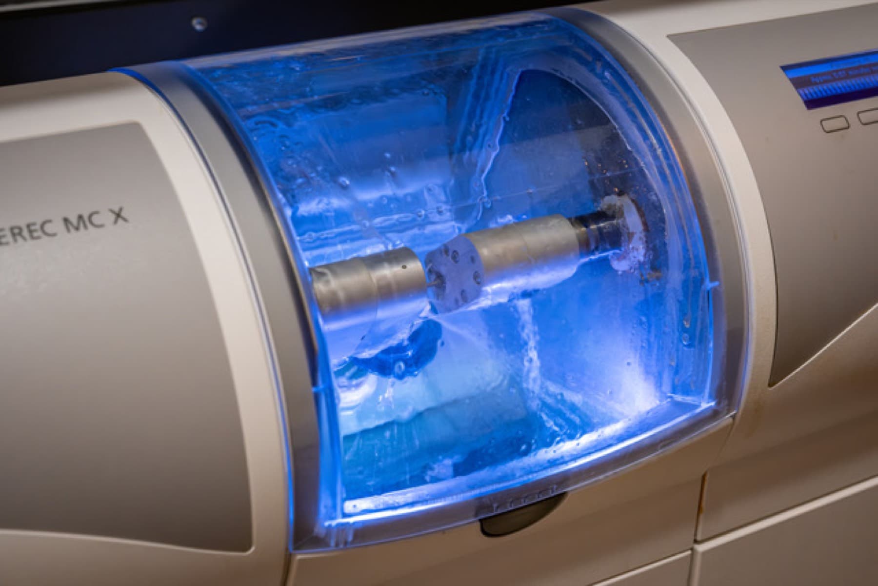 CEREC Same-Day Crowns at iDental Dilworth in Charlotte, NC